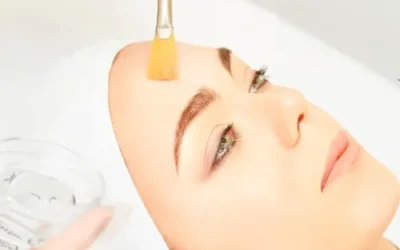 Peeling químico: Tecnología avanzada para renovar la piel